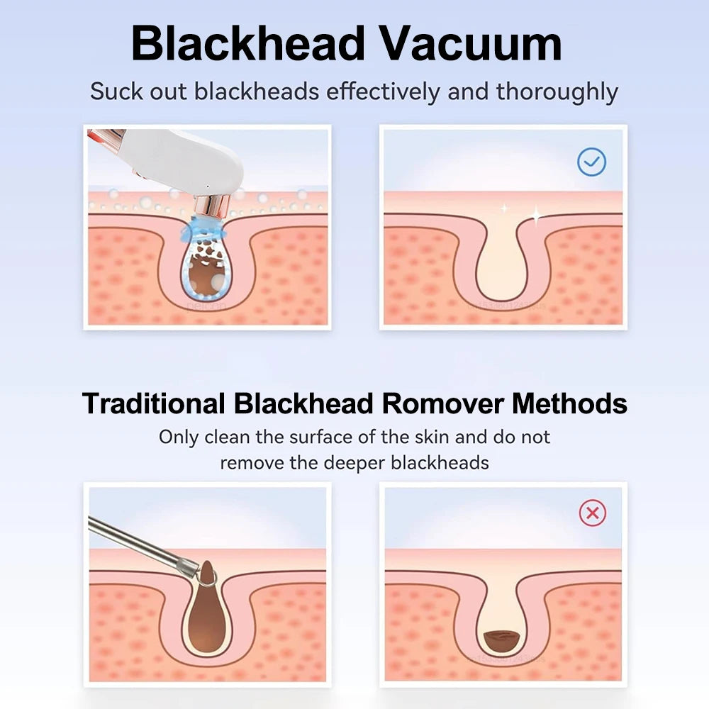 Blackhead Remover Electric Black Head Remover Pore Vacuum Cleaner Micro Small Bubble Rechargeable Water Cycle Black Dot Remove