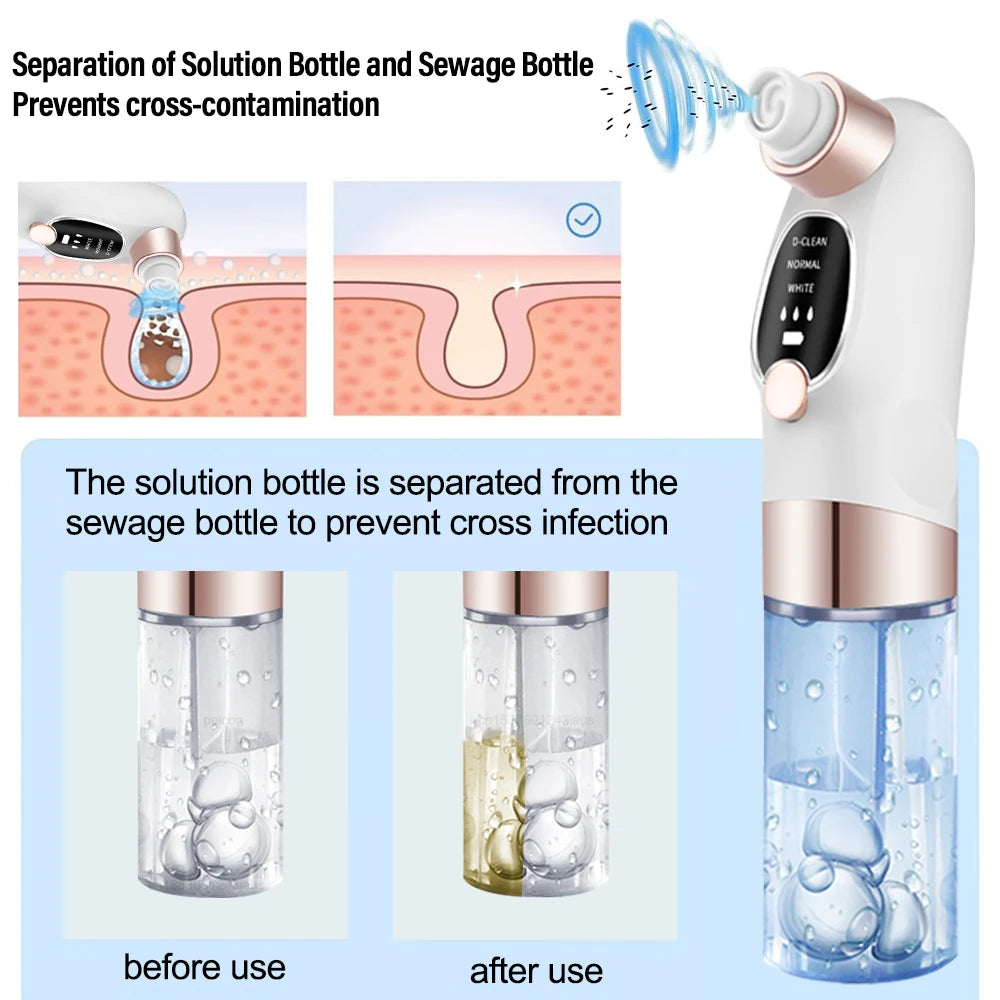 Blackhead Remover Electric Black Head Remover Pore Vacuum Cleaner Micro Small Bubble Rechargeable Water Cycle Black Dot Remove