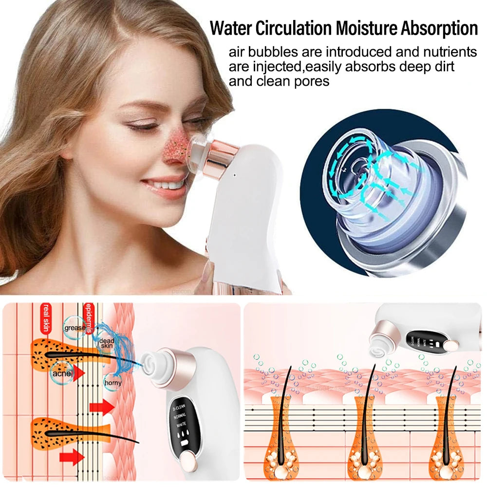 Blackhead Remover Electric Black Head Remover Pore Vacuum Cleaner Micro Small Bubble Rechargeable Water Cycle Black Dot Remove
